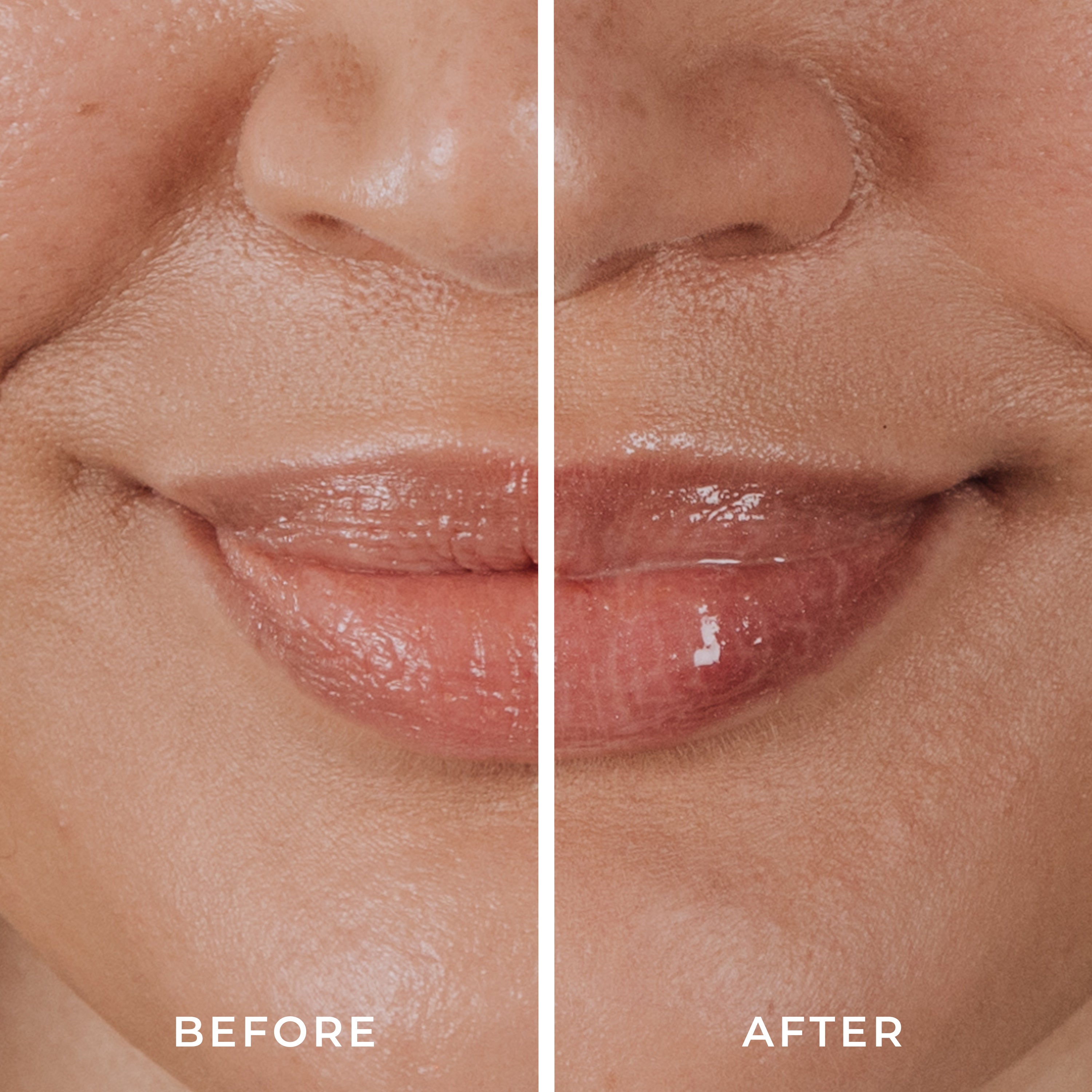 Cloud Balm Hydrating Lip Treatment with Bakuchiol